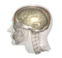 It doesn't take much to injure the brain - SDBrainCenter