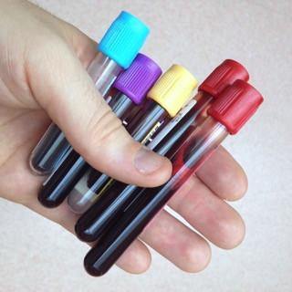 Hand holding blood test tubes with colored caps for lab testing and health analysis